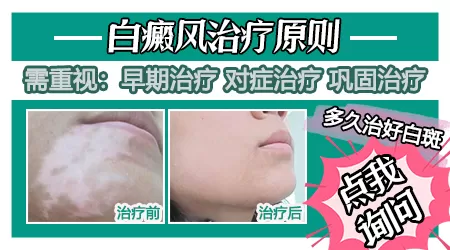 宝宝下巴皮肤白块
