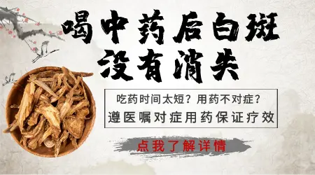 白癜风喝中药半年不管用怎么办