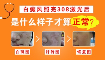 照完308激光白斑部位泛红怎么回事