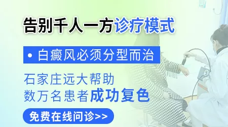 白癜风能不能治好