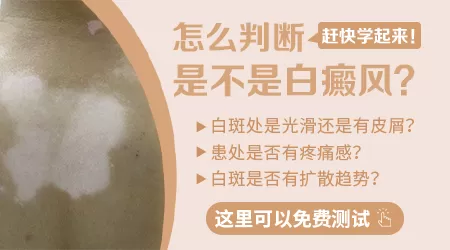 青少年脸上有白斑怎么回事