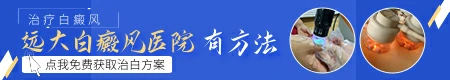 苏孜阿甫片治疗白癜风效果如何