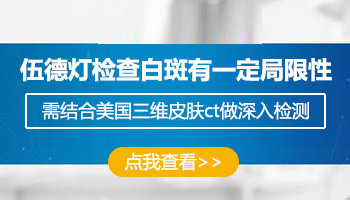 手指皮肤在伍德灯下有一块白斑是不是白癜风