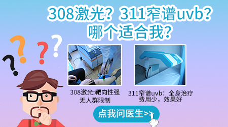 白癜风长在头上用311还是308 哪个好仪器