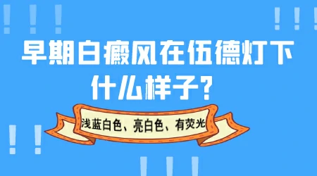 皮肤ct和皮肤镜哪个查白斑更准