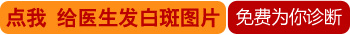 白斑不痛不痒是不是白癜风 怎么判断