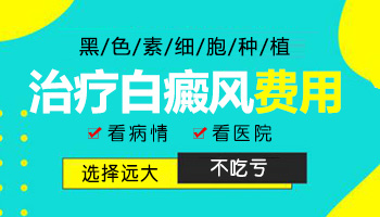 白癜风黑色素种植多少钱 能报医保吗