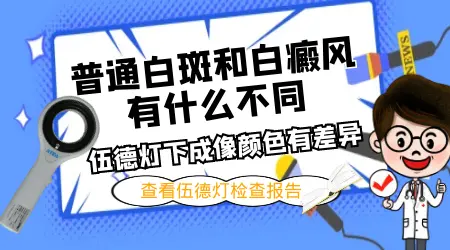 儿童皮肤白斑 白癜风初期和普通白斑区别