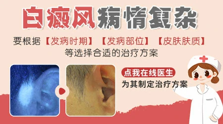 白癜风半年了还能治好吗