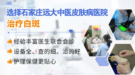 白癜风照光后起泡疹应如何处理