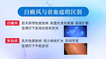 贫血痣图片和白斑的区别