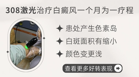 308激光治疗白癜风一个疗程要多少钱