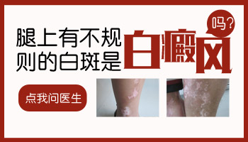 小孩大腿上出现了白斑是什么