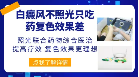 治白癜风不照光直接吃中药行吗