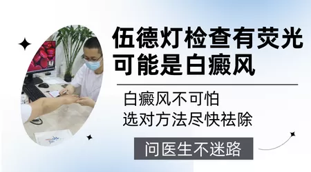 伍德灯能不能确诊早期白癜风