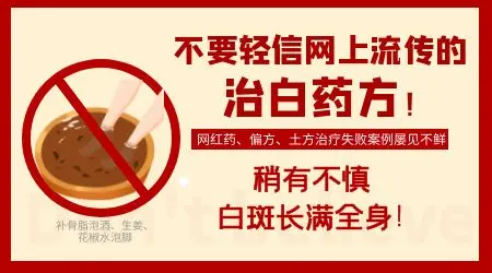 伍德灯检查白斑蓝白色好治吗