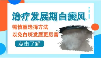 青少年脸上白癜风越来越多如何控制