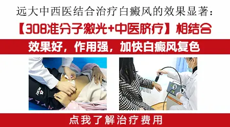石家庄哪家医院中西医结合治白癜风