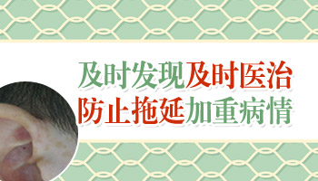 男性腹股沟变白是为什么