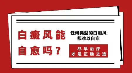 白癜风不治而愈可能吗