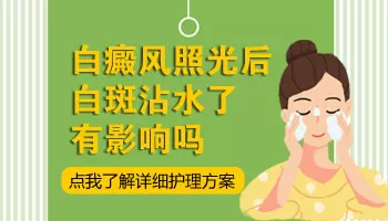 白癜风照了308洗澡了怎么办