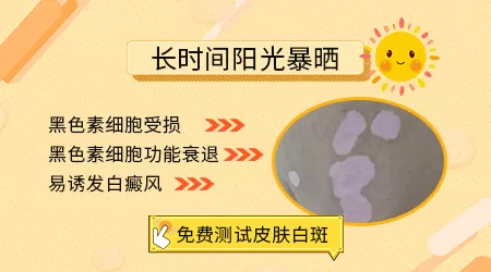 为什么得白癜风的人这么多