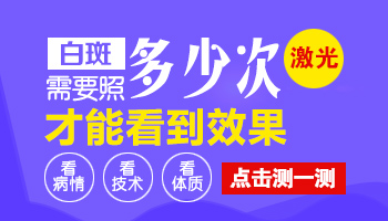 节段性白癜风做308激光多少次有效果