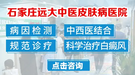 补骨脂有可能导致白癜风扩散吗