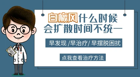 手上有白斑会不会扩散到脸上