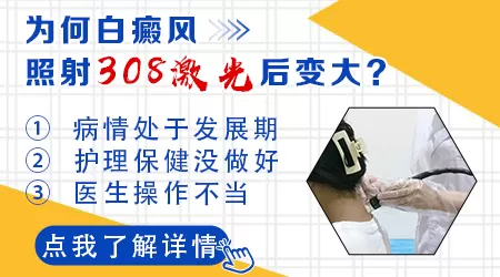 为什么308激光治疗白癜风后面积变大了