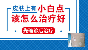 额头出现三个白点吃啥药好得快