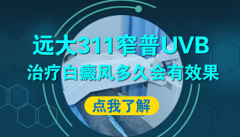 紫外线光疗仪照射白癜风多久能有效果