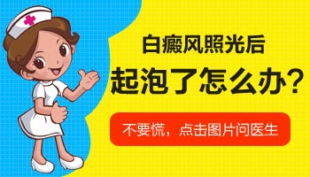 白癜风激光后有水泡是怎么回事