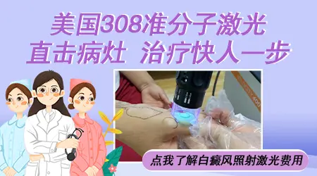 照308激光白斑会变大吗