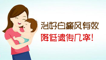 白癜风多少年不扩散可以要小孩吗