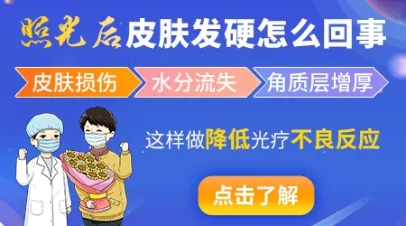 白斑照光能停照吗