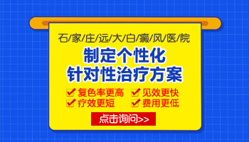 紫外线灯照白斑一次多长时间