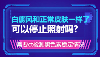 白癜风长出黑色素还要继续治疗吗