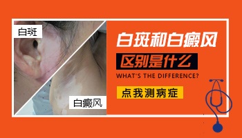 白色糠疹和白癜风白斑区别