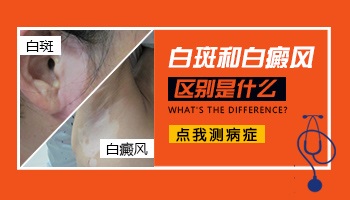 白色糠疹和白癜风白斑区别