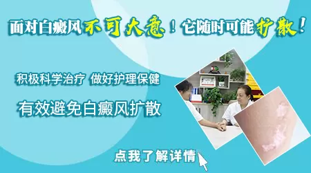 腿上的白癜风会不会长到脸上