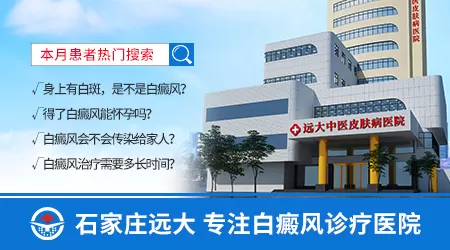 白癜风黑色素移植后会遗留瘢痕吗