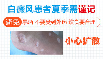 专题报道：夏季白癜风患者如何控制好情绪