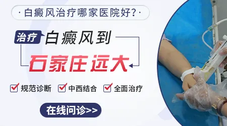 石家庄治白癜风去哪个医院效果好花费低