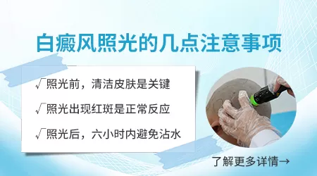 白癜风治疗仪308和311有啥区别