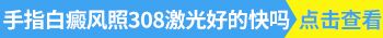 手指白癜风照311效果咋样