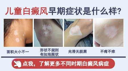 宝宝大腿不规则白块是什么