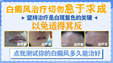 冬季治白癜风的方法 如何避免扩散