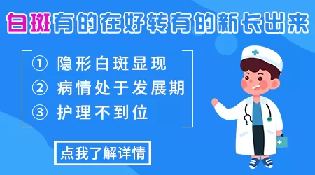 白癜风照308好转后又会扩大吗