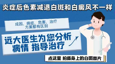 色素脱失是白癜风吗
